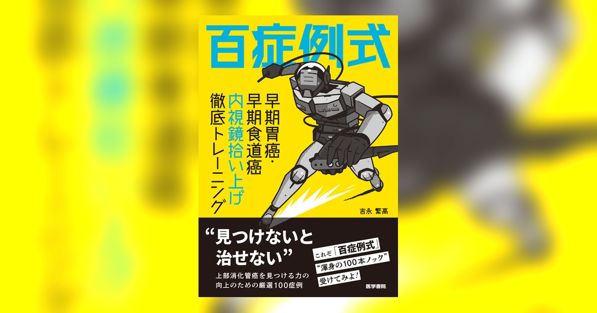 【中古】通常内視鏡観察による早期胃癌の拾い上げと診断 百症例式 早期胃癌・早期食道癌 内視鏡拾い上げ徹底トレーニング