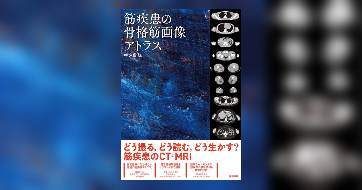 【裁断済】筋疾患の骨格筋画像アトラス 筋疾患の骨格筋画像アトラス | 書籍詳細 | 書籍 | 医学書院