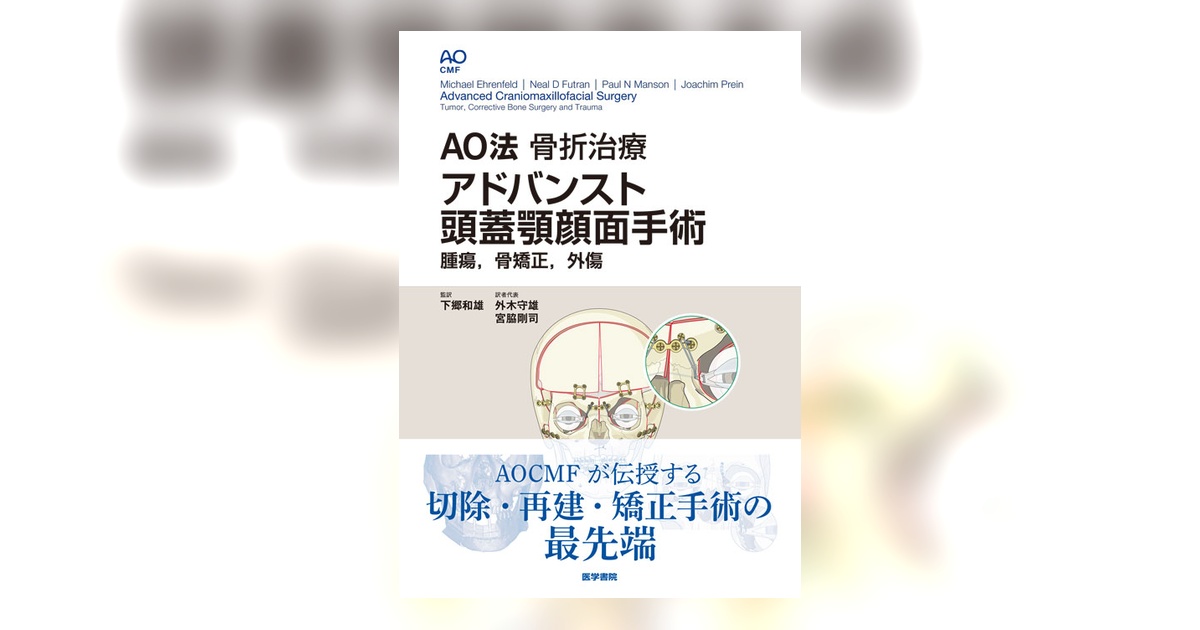 AO法骨折治療 アドバンスト頭蓋顎顔面手術 | 書籍詳細 | 書籍 | 医学書院