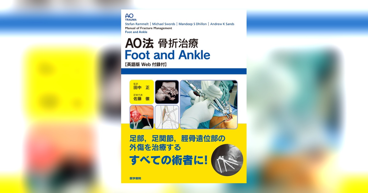 AO法骨折治療 Foot and Ankle [英語版Web付録付] AO法骨折治療 Foot and Ankle ［英語版Web付録付］ | 書籍詳細 | 書籍