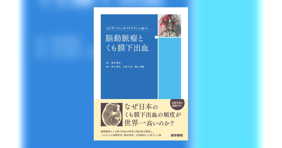 エビデンスとガイドラインに基づく脳動脈瘤とくも膜下出血 | 書籍詳細