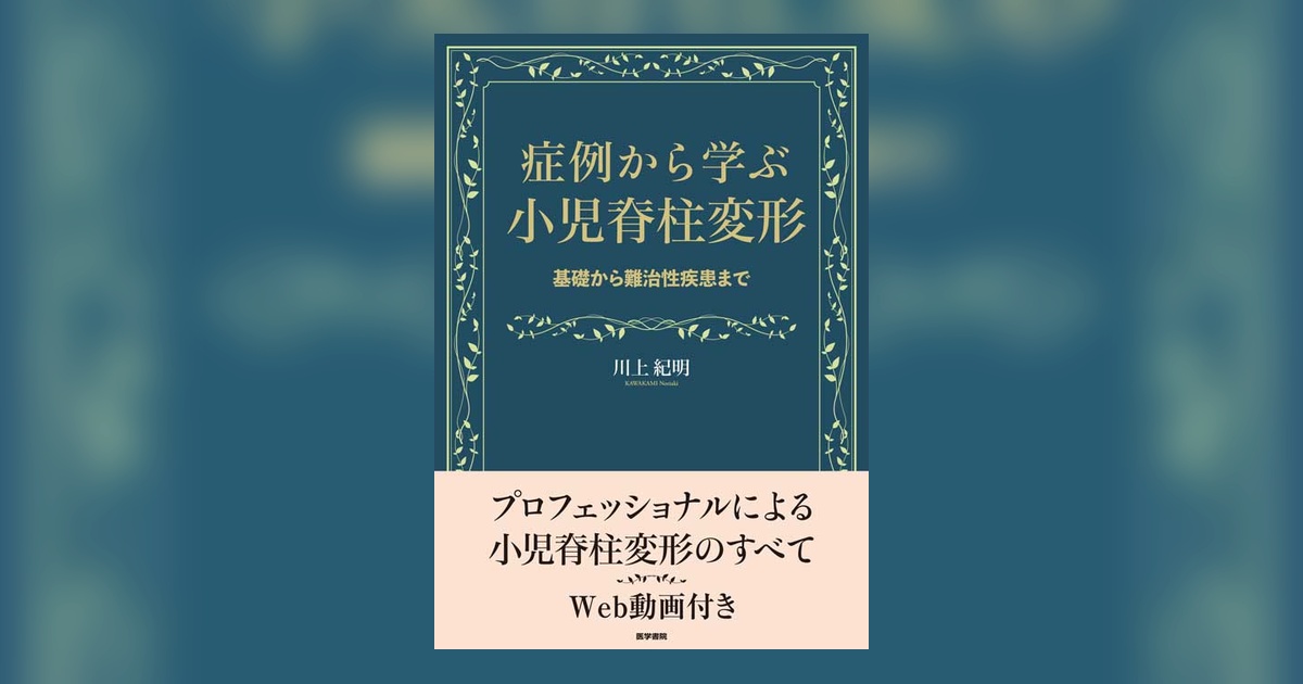 小児脊柱変形治療の最前線 小児脊柱変形治療の最前線 小児脊柱変形治療の最前線 : 小児脊柱