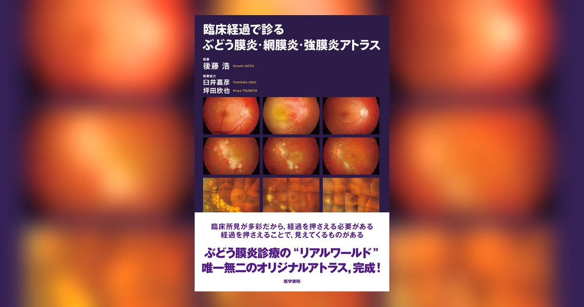 臨床経過で診る ぶどう膜炎・網膜炎・強膜炎アトラス | 書籍詳細