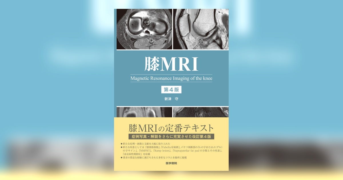 膝MRI 第4版 | 書籍詳細 | 書籍 | 医学書院
