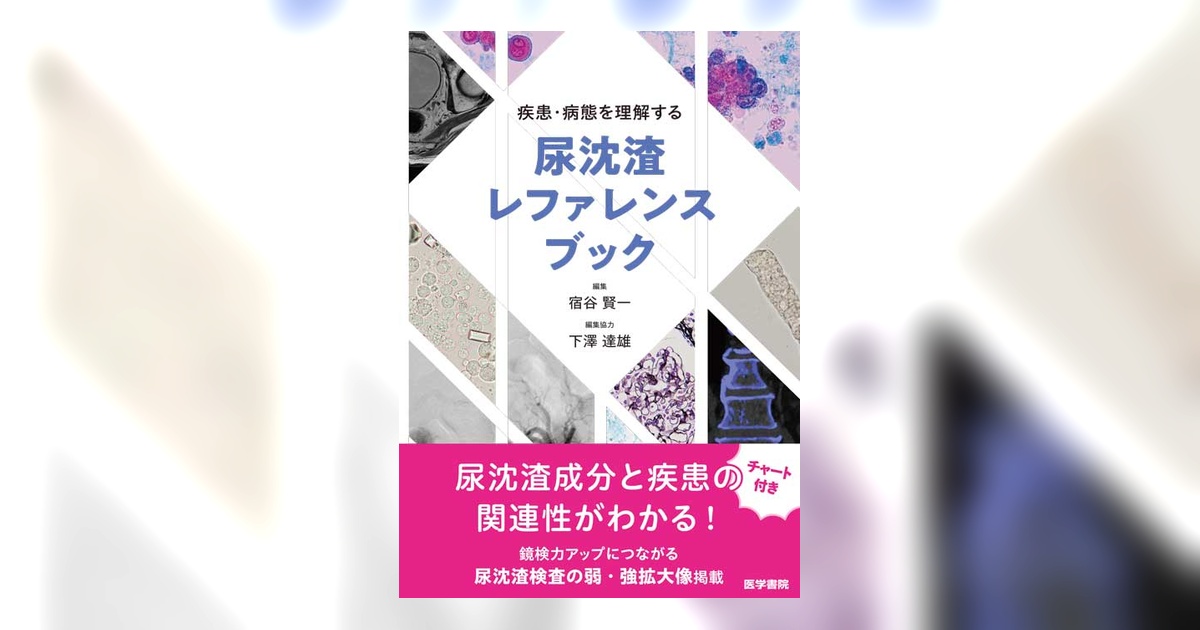 疾患・病態を理解する尿沈渣レファレンスブック | 書籍詳細 | 書籍