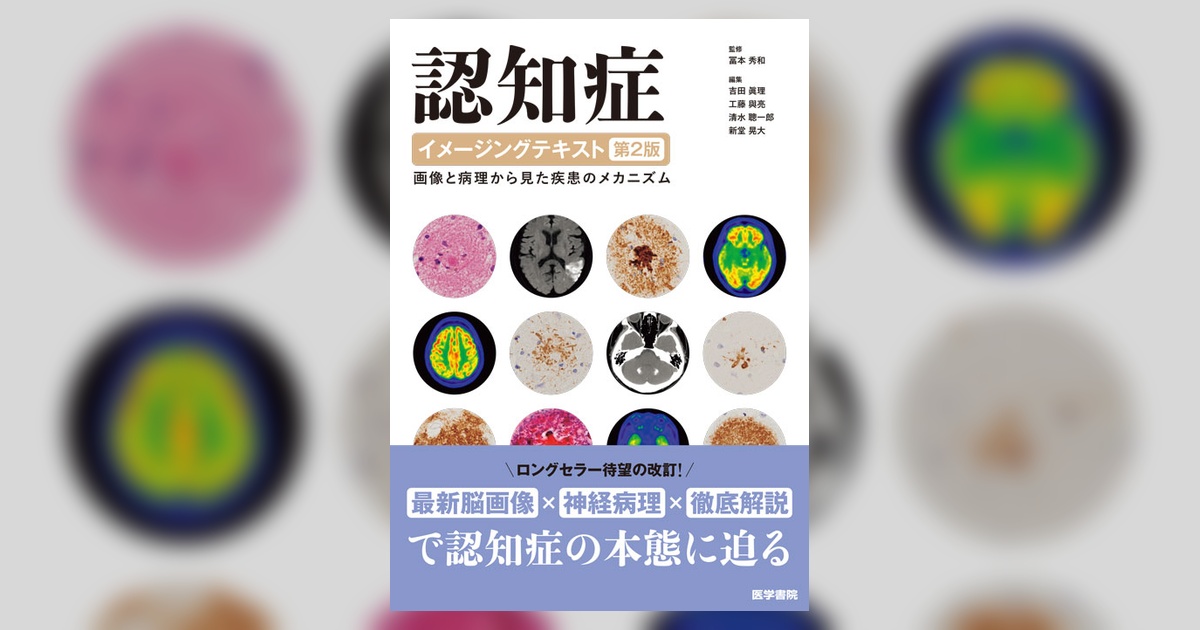認知症イメージングテキスト 第2版 | 書籍詳細 | 書籍 | 医学書院