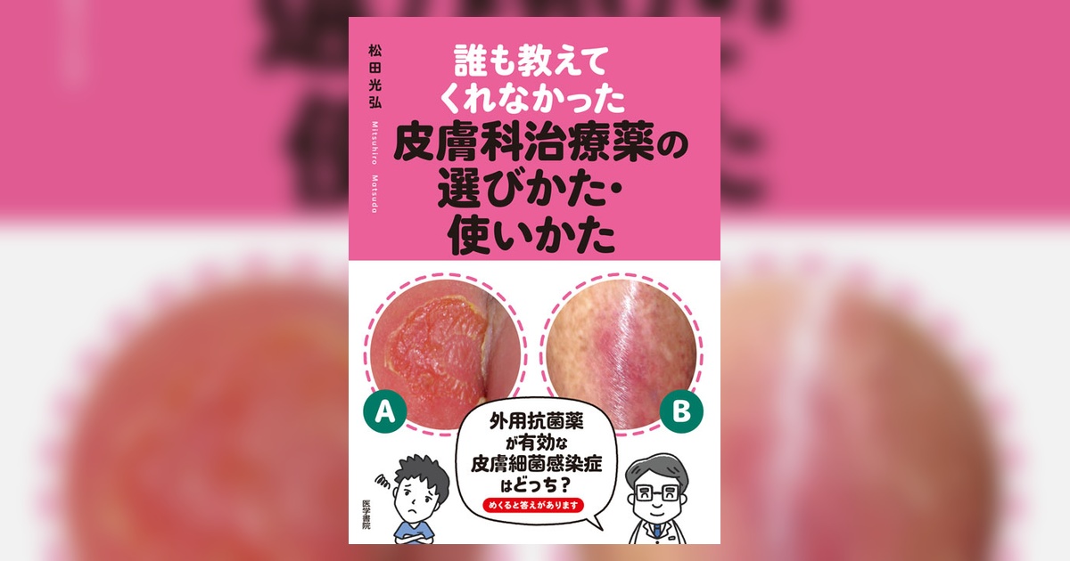 誰も教えてくれなかった皮膚科治療薬の選びかた・使いかた | 書籍詳細