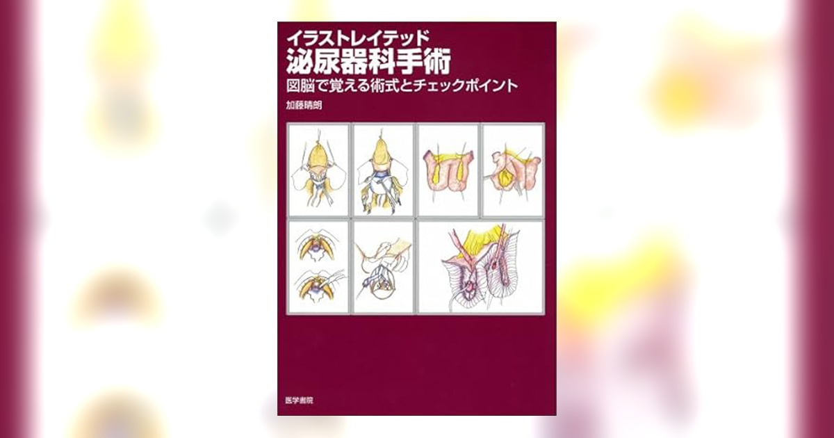イラストレイテッド泌尿器科手術 図脳で覚える術式とチェックポイント 加藤 晴朗 Amazon.co.jp: イラストレイテッド泌尿器科手術―図脳で覚える術式と