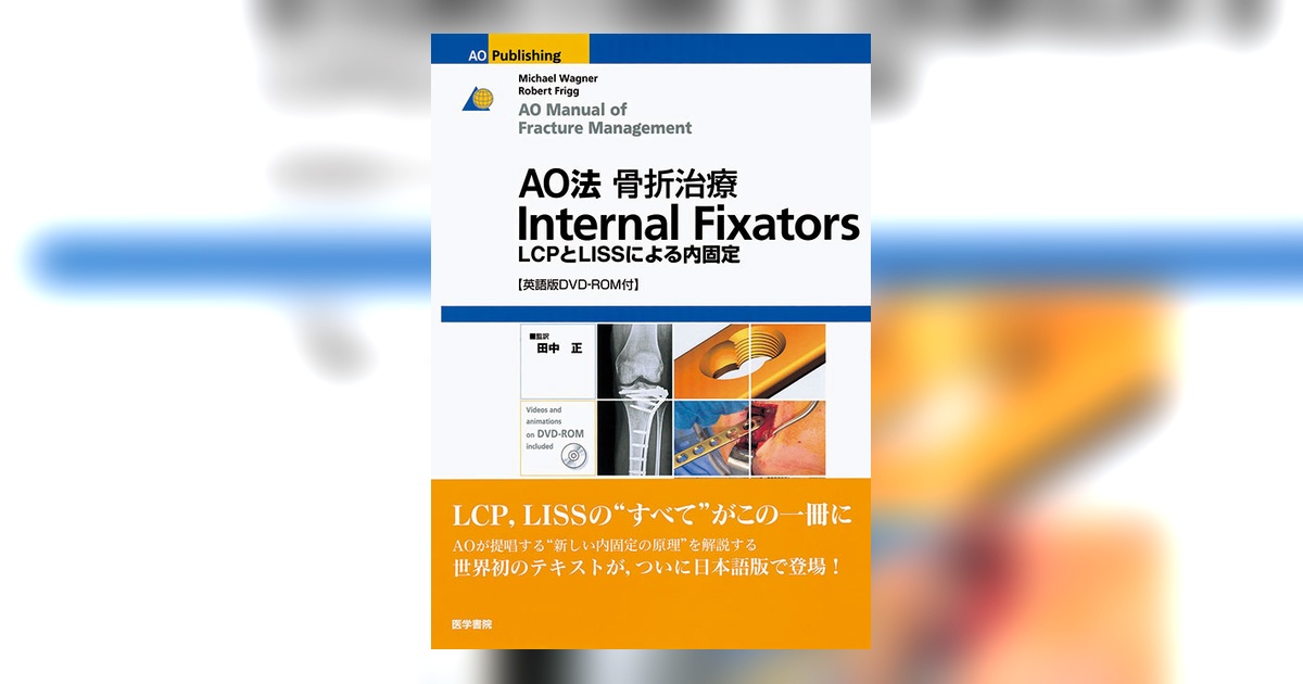 AO法 骨折治療 Internal Fixators AO法骨折治療 Internal Fixators [英語版DVD-ROM付] | 書籍詳細 | 書籍