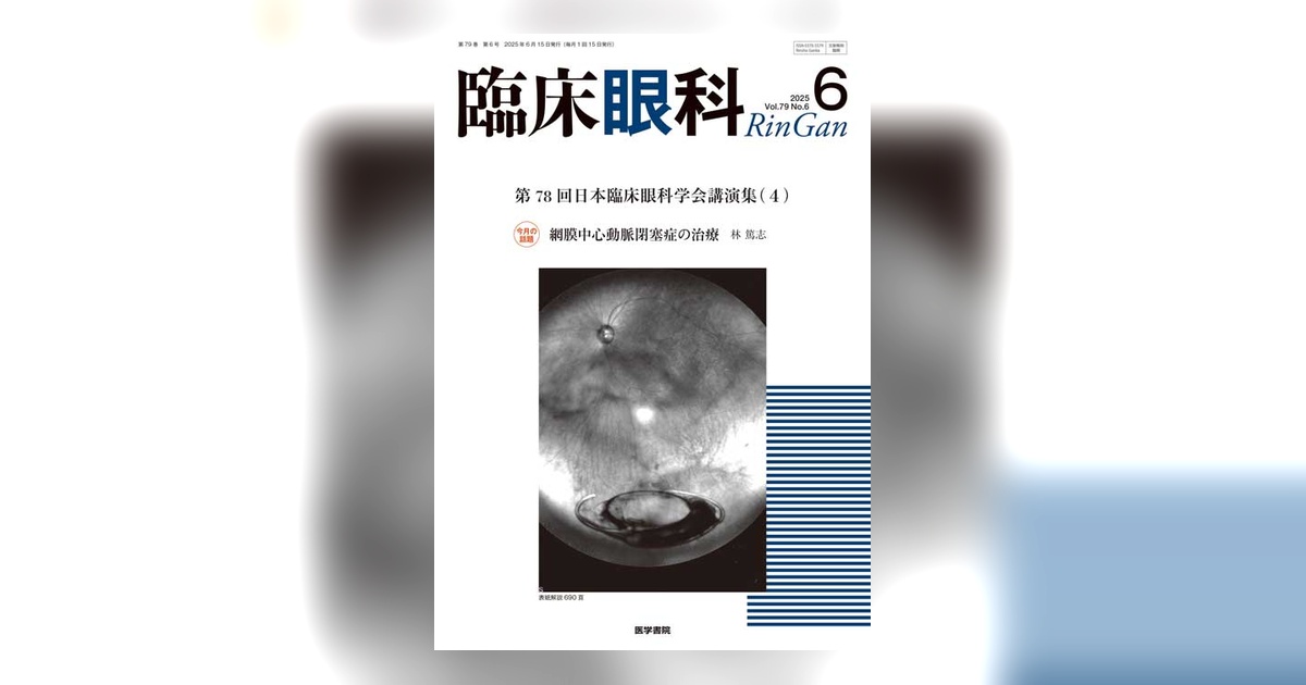 臨床眼科 Vol.79 No.6 | 雑誌詳細 | 雑誌 | 医学書院