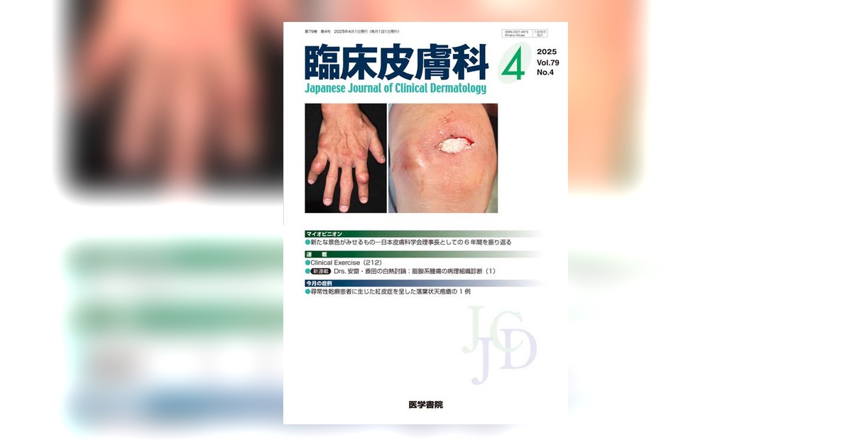臨床皮膚科 Vol.79 No.4 | 雑誌詳細 | 雑誌 | 医学書院