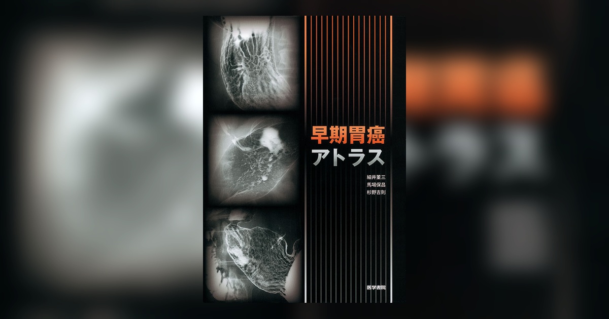 早期胃癌アトラス | 書籍詳細 | 書籍 | 医学書院