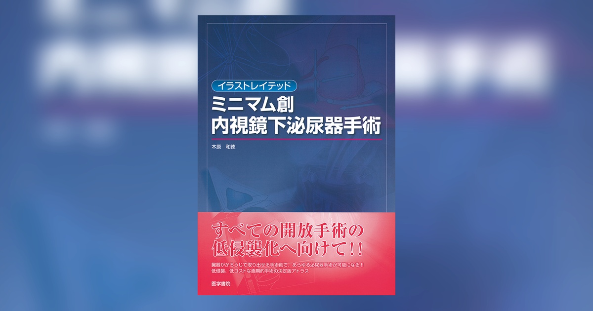 イラストレイテッド ミニマム創 内視鏡下泌尿器手術 | 書籍詳細 | 書籍