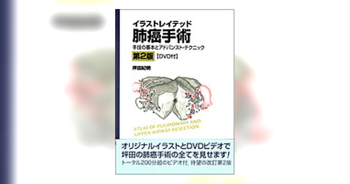 イラストレイテッド肺癌手術 [DVD付] 第2版 | 書籍詳細 | 書籍 | 医学書院
