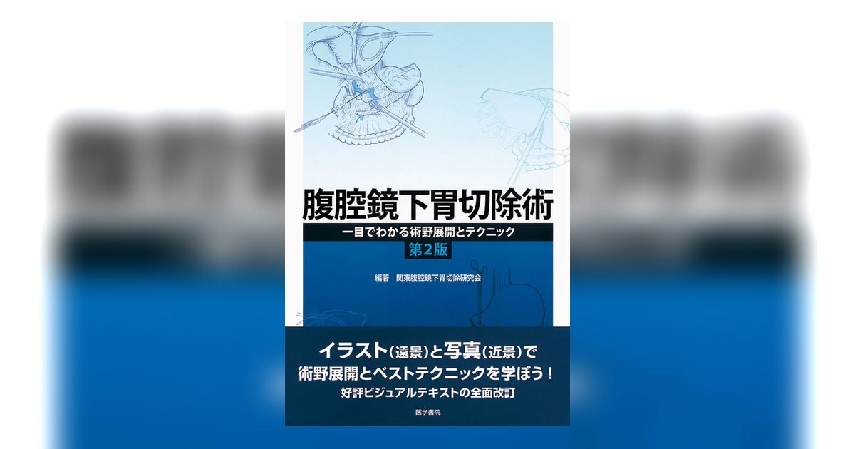 腹腔鏡下胃切除術 第2版 | 書籍詳細 | 書籍 | 医学書院