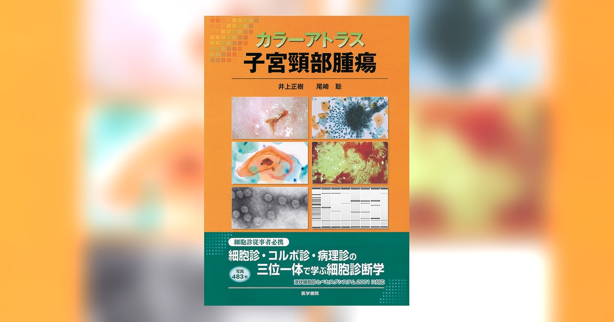 ヨコハマシステム準拠子宮内膜細胞診アトラス ヨコハマシステム準拠 子宮内膜細胞診アトラス