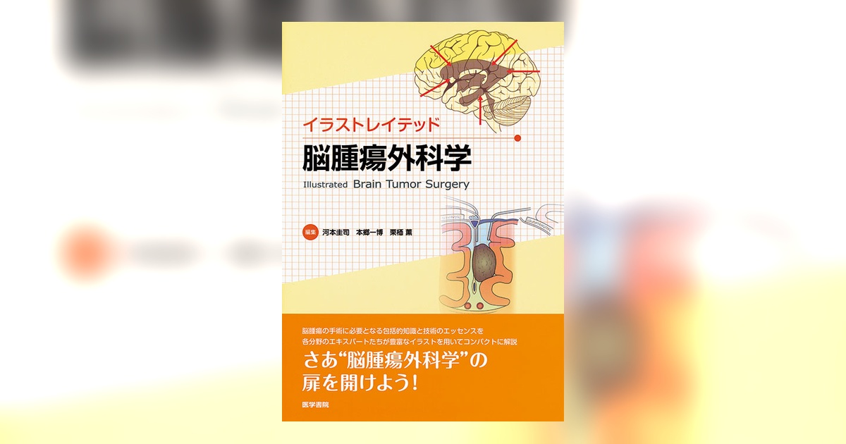 イラストレイテッド 脳腫瘍外科学 | 書籍詳細 | 書籍 | 医学書院