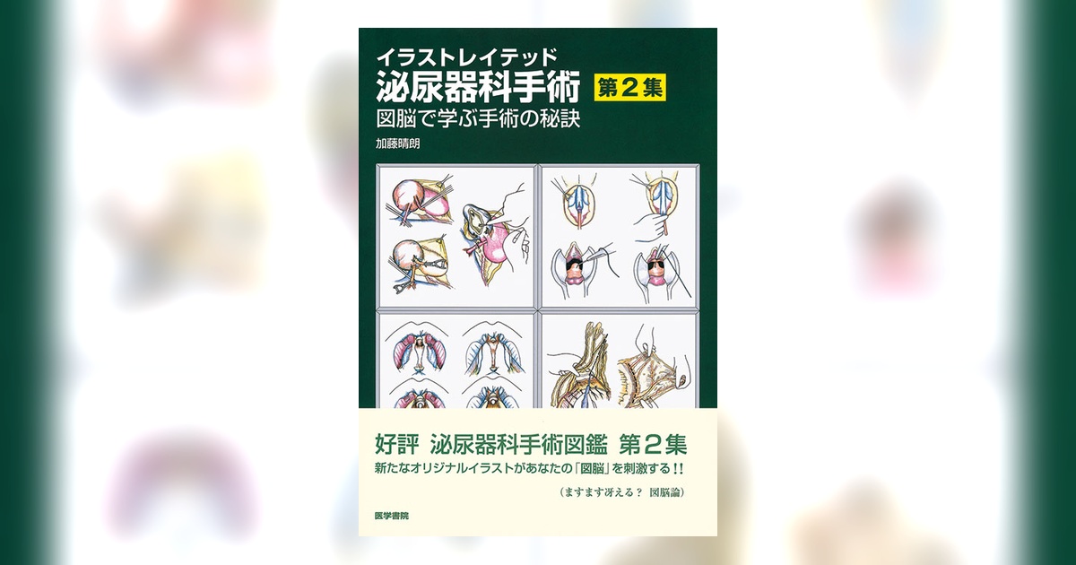 （裁断済）イラストレイテッド泌尿器科手術 : 図脳で覚える術式とチェックポイント イラストレイテッド泌尿器科手術 | 書籍詳細 | 書籍 | 医学書院
