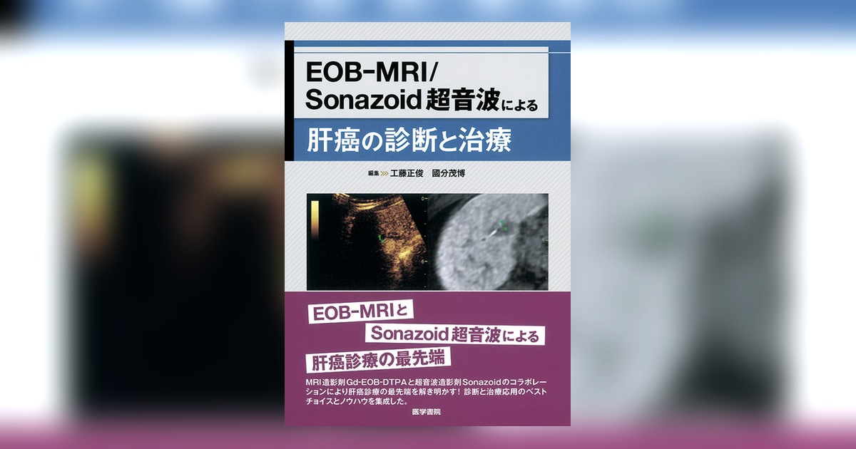EOB-MRI/Sonazoid 超音波による肝癌の診断と治療 | 書籍詳細 | 書籍