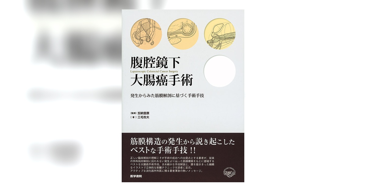 腹腔鏡下大腸癌手術 発生からみた筋膜解剖に基づく手術手技 腹腔鏡下大腸癌手術 | 書籍詳細 | 書籍 | 医学書院