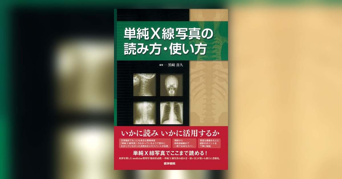 単純X線写真の読み方・使い方 | 書籍詳細 | 書籍 | 医学書院