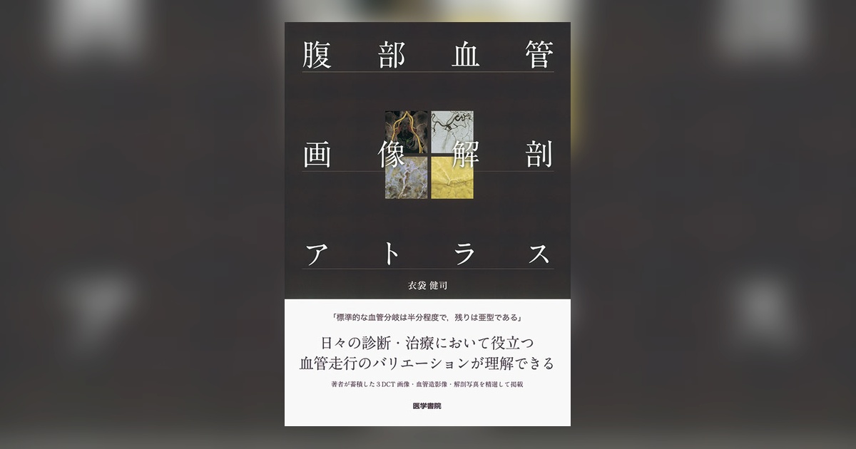 腹部血管画像解剖アトラス | 書籍詳細 | 書籍 | 医学書院