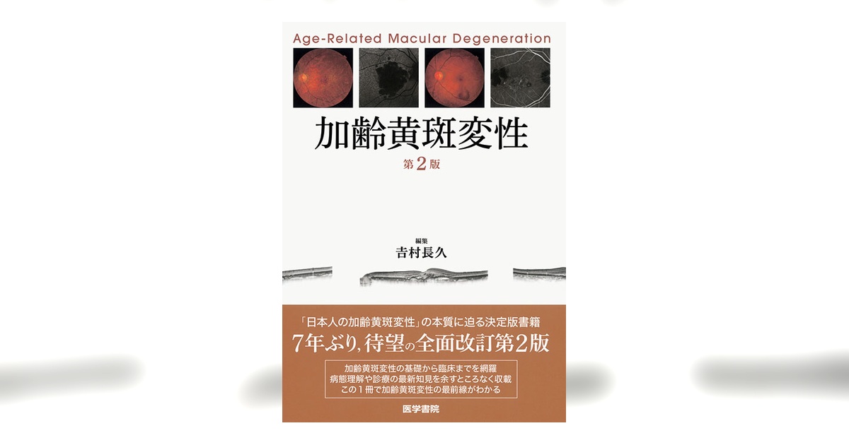 加齢黄斑変性 第2版 | 書籍詳細 | 書籍 | 医学書院