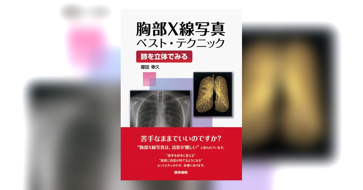 胸部X線写真ベスト・テクニック | 書籍詳細 | 書籍 | 医学書院