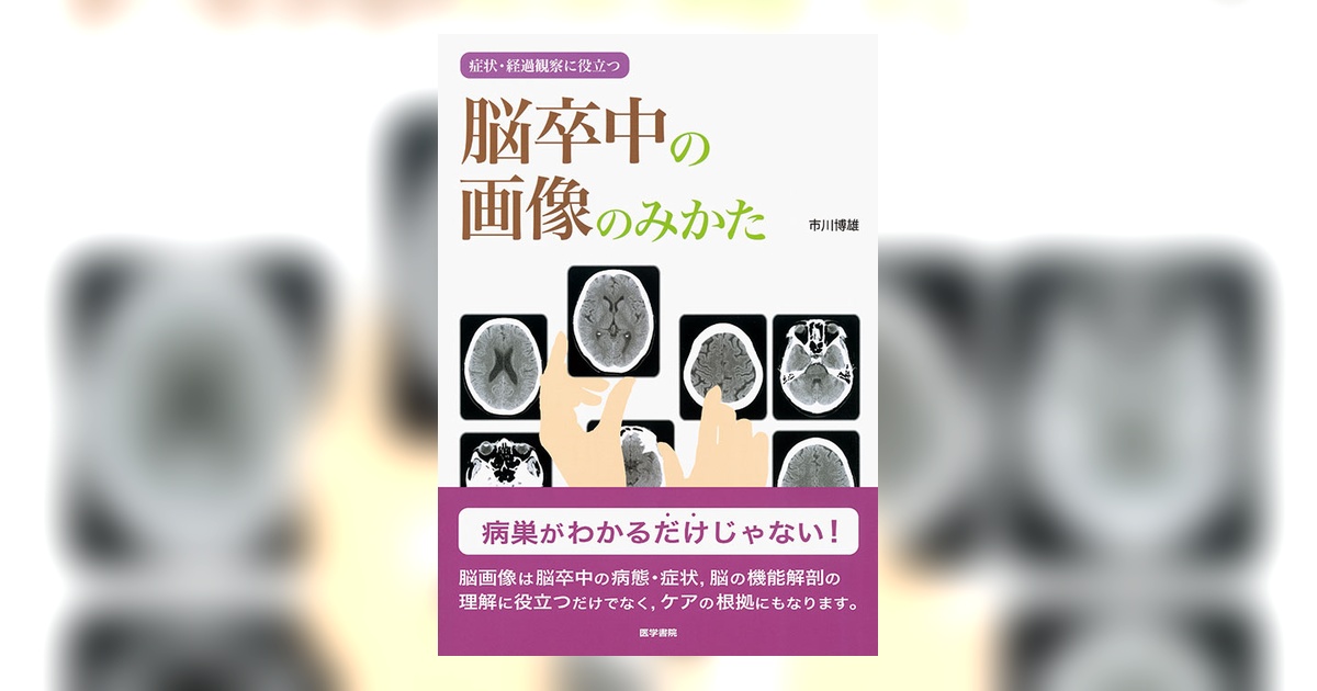 脳卒中の画像のみかた | 書籍詳細 | 書籍 | 医学書院