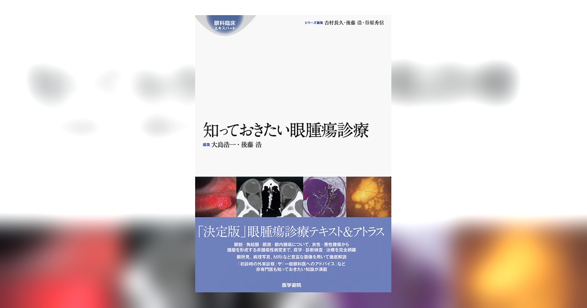 ★裁断済★ 知っておきたい眼腫瘍診療 知っておきたい眼腫瘍診療 | 書籍詳細 | 書籍 | 医学書院