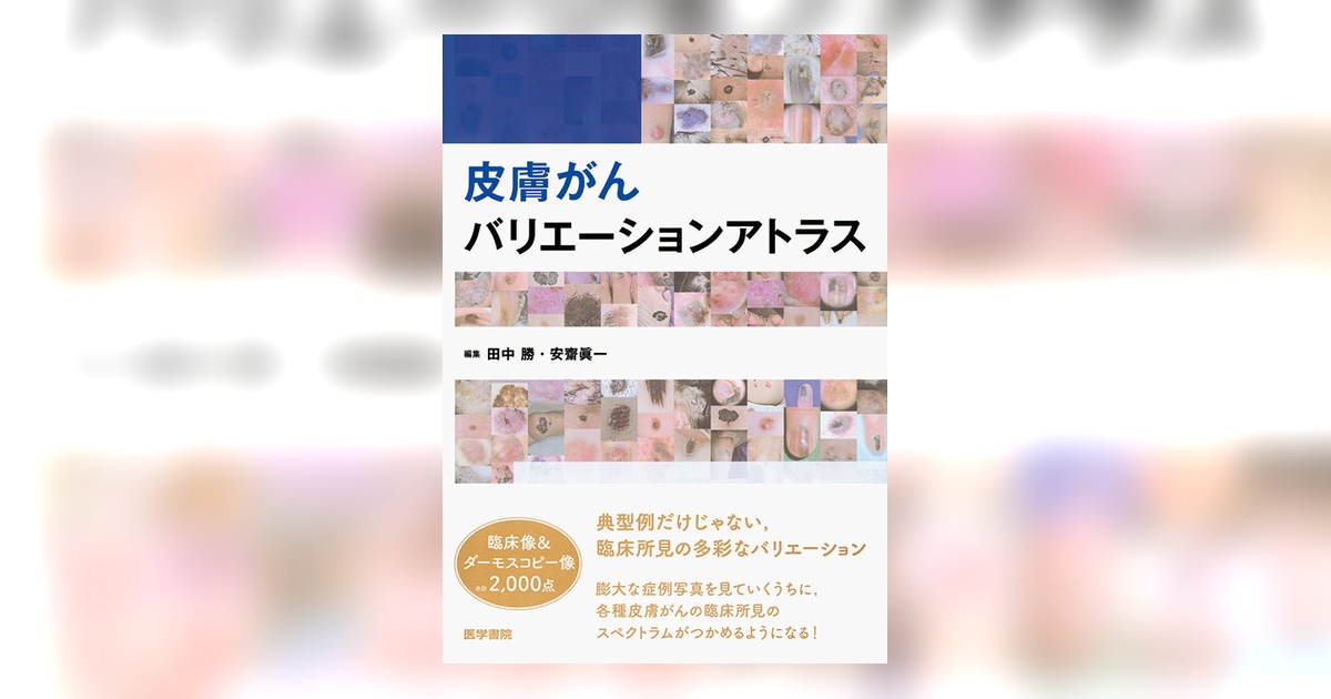 皮膚がんバリエーションアトラス | 書籍詳細 | 書籍 | 医学書院