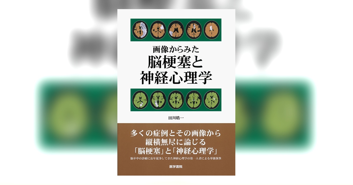 画像からみた脳梗塞と神経心理学 画像からみた 脳梗塞と神経心理学 | 田川 皓一 |本 | 通販 | Amazon