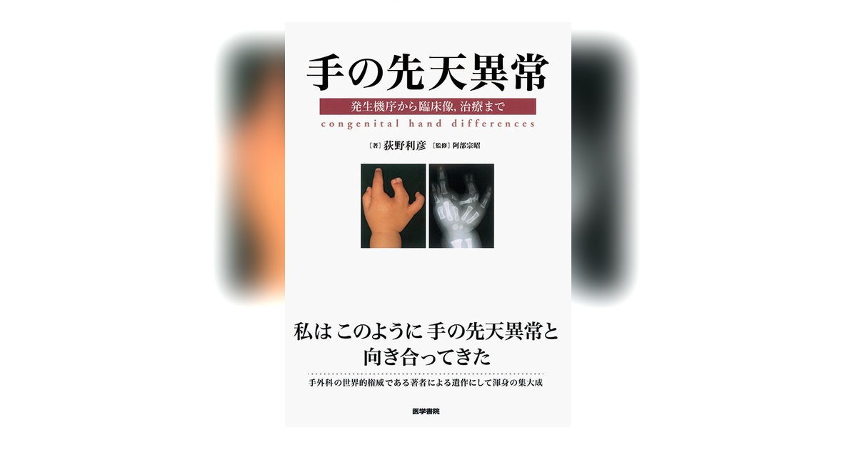 手の先天異常 | 書籍詳細 | 書籍 | 医学書院