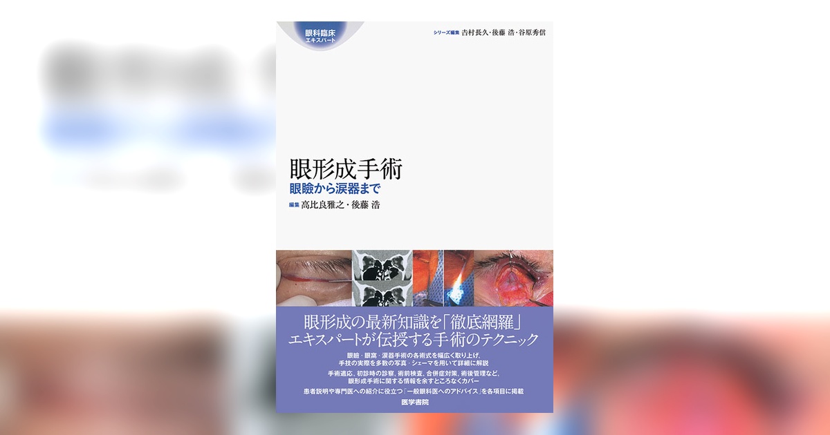 眼形成手術 | 書籍詳細 | 書籍 | 医学書院
