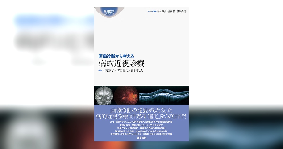 画像診断から考える病的近視診療 | 書籍詳細 | 書籍 | 医学書院