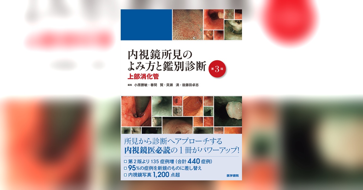 内視鏡所見のよみ方と鑑別診断－上部消化管 | 書籍詳細 | 書籍 | 医学書院