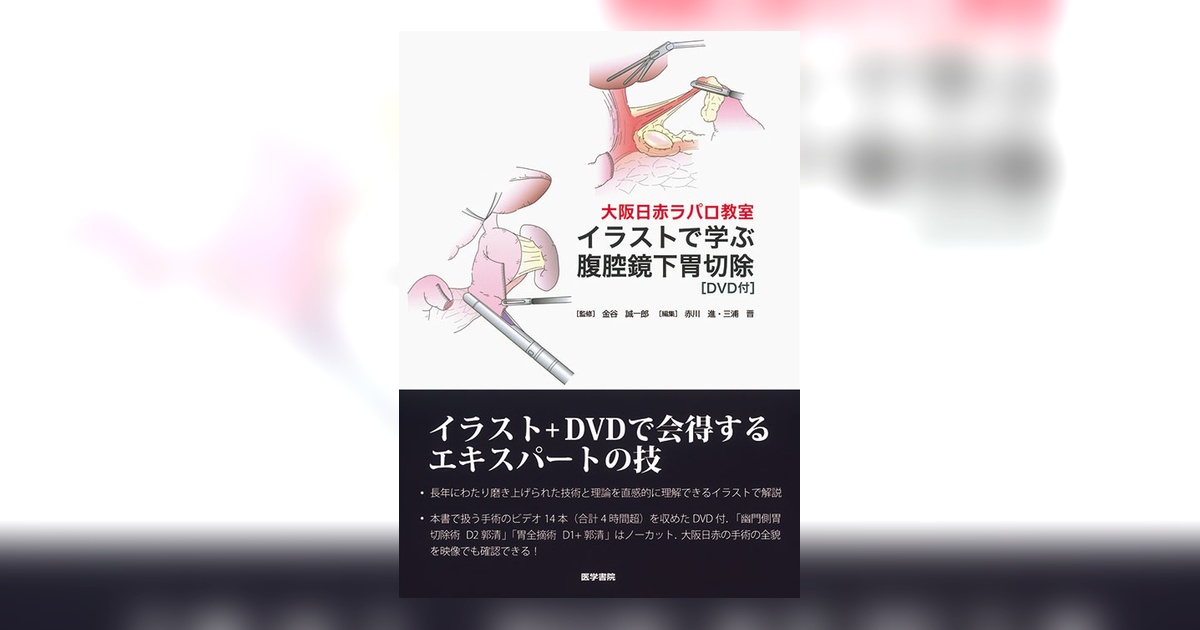 イラストで学ぶ腹腔鏡下胃切除［DVD付］ | 書籍詳細 | 書籍 | 医学書院