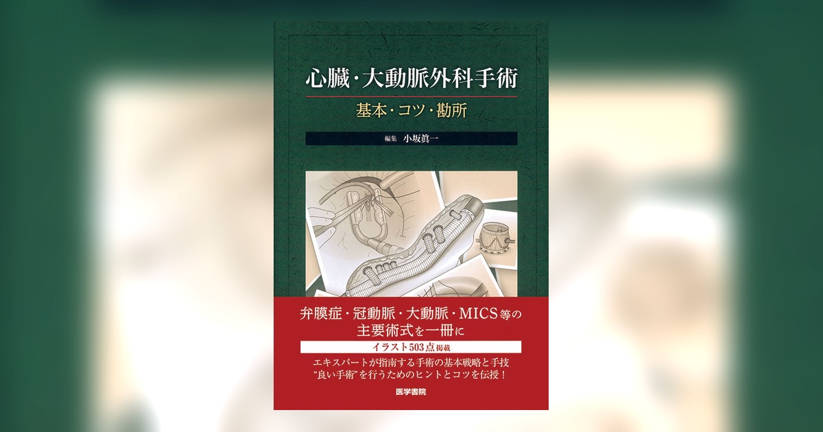 心臓・大動脈外科手術 基本・コツ・勘所 心臓・大動脈外科手術 | 書籍詳細 | 書籍 | 医学書院