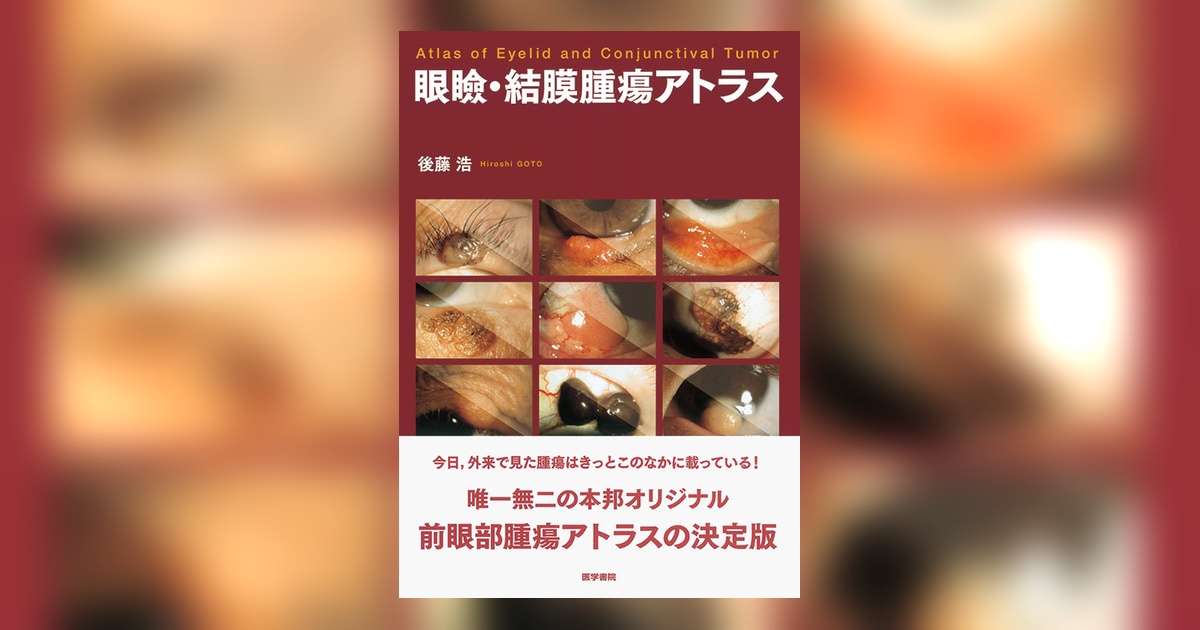 眼瞼・結膜腫瘍アトラス | 書籍詳細 | 書籍 | 医学書院
