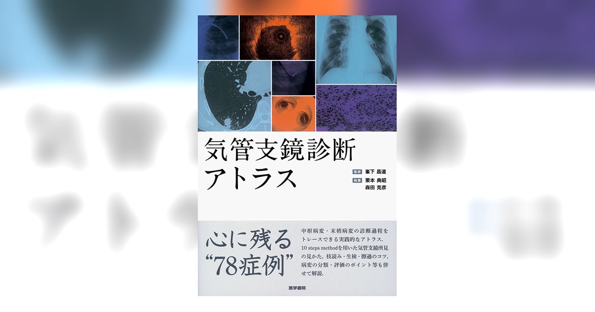 気管支鏡診断アトラス | 書籍詳細 | 書籍 | 医学書院 気管支鏡診断アトラス | 書籍詳細 | 書籍 | 医学書院