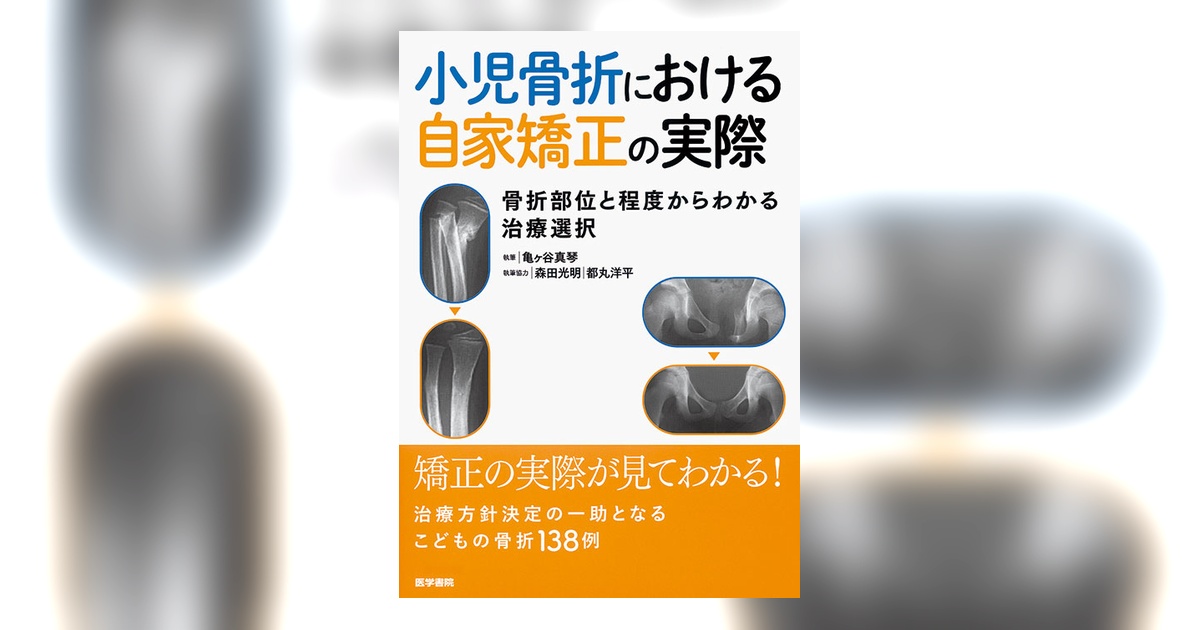 小児骨折における自家矯正の実際 | 書籍詳細 | 書籍 | 医学書院
