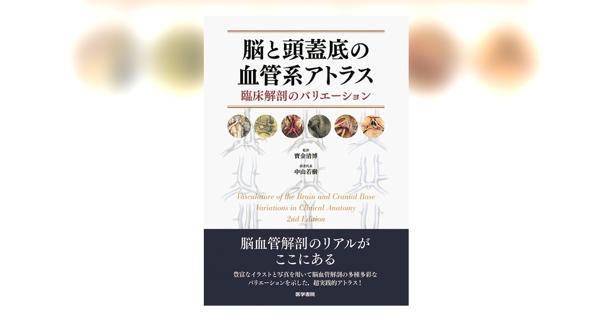 脳と頭蓋底の血管系アトラス 第2版 脳と頭蓋底の血管系アトラス / 寳金清博/中山若樹 - 紀伊國屋書店