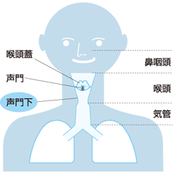 呼吸促迫のマネジメント 2 上気道閉塞その1 クループ症候群 土畠智幸 09年 記事一覧 医学界新聞 医学書院