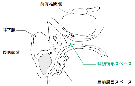 耳鼻科 咽後膿瘍 志賀隆 2010年 記事一覧 医学界新聞 医学書院