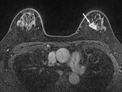 乳腺領域 後藤眞理子 隈丸加奈子 2017年 記事一覧 医学界新聞 医学書院