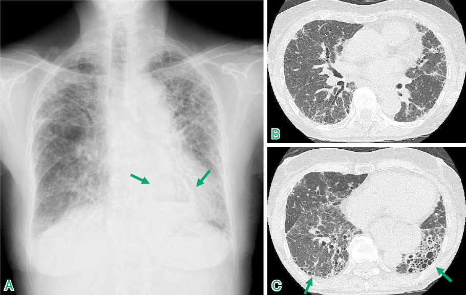 IPFはどう違うのですか？