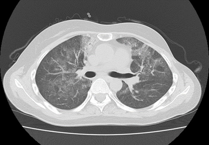 高齢者新興感染症 Emerging Infectious Disease In The Elderly 岸田直樹 18年 記事一覧 医学界新聞 医学書院