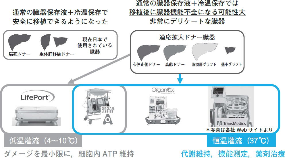 ドナー不足問題を解決する移植医療の最新技術 Ex Vivo Machine Perfusion Mp 後藤徹 19年 記事一覧 医学界新聞 医学書院 ドナー不足問題を解決する移植医療の最新技術 Ex Vivo Machine Perfusion Mp 後藤徹 19年 記事一覧 医学界新聞 医学書院
