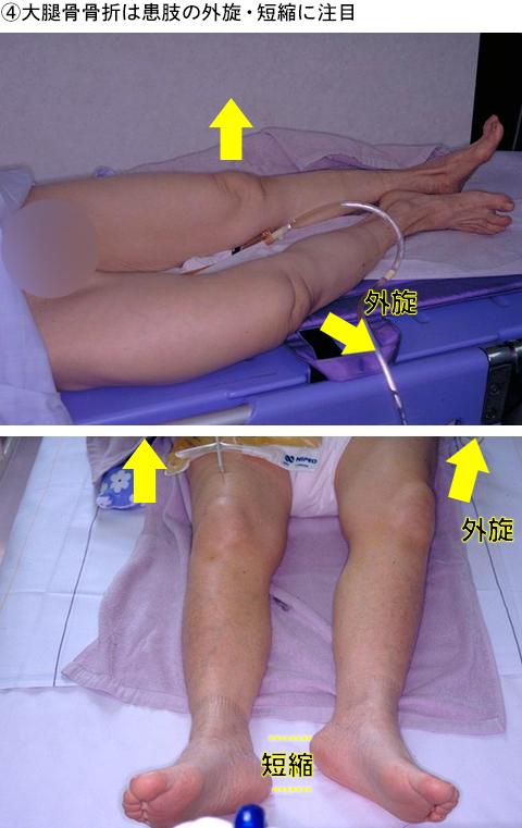 一発診断できる整形外科疾患を見てみよう 仲田和正 19年 記事一覧 医学界新聞 医学書院