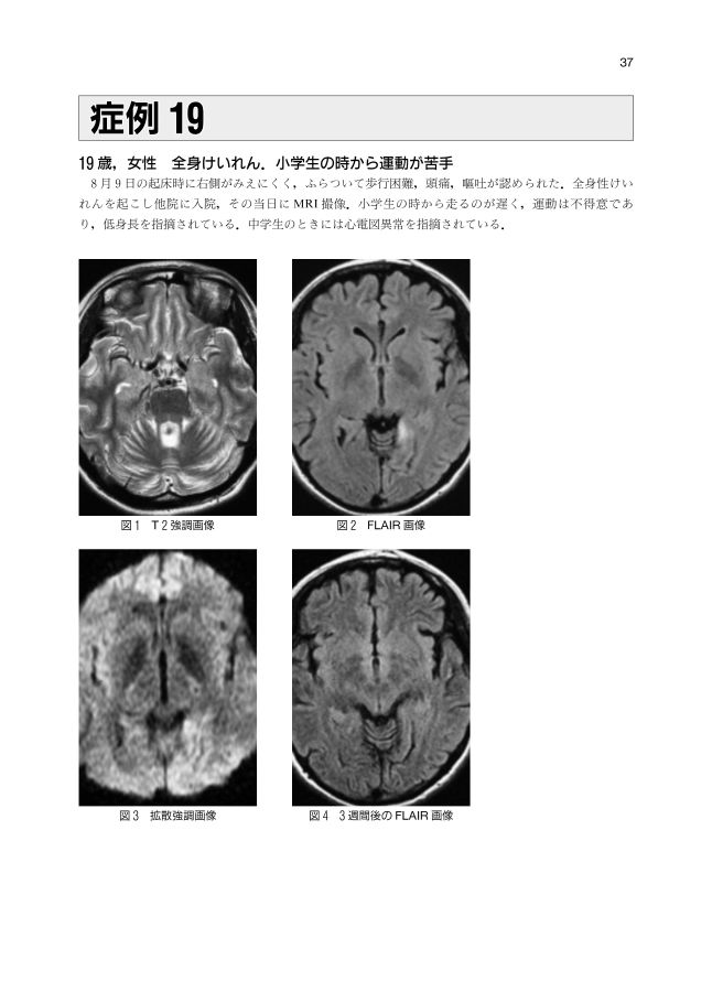 症例から学ぶ神経疾患の画像と病理 症例から学ぶ神経疾患の画像と病理_立読み